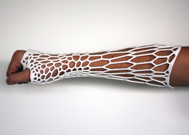 dezeen_Cortex-3D-printed-cast-for-broken-bones-by-Jake-Evill-2
