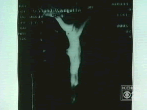 mri.gif