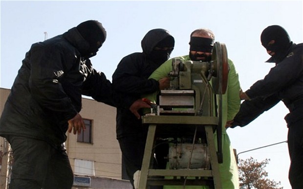 iran-amputation-3_2464258b